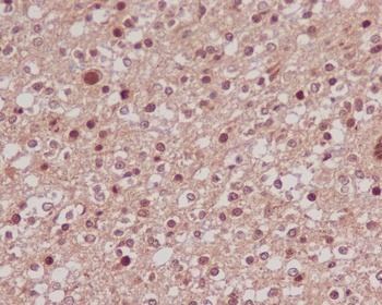 FoxO1a Rabbit Monoclonal Antibody