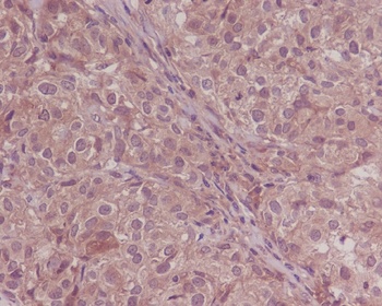 Smad4 Rabbit Monoclonal Antibody