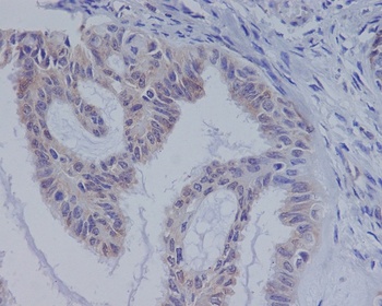 B Raf Rabbit Monoclonal Antibody