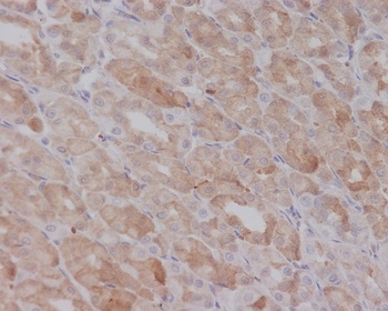 Smad2 Rabbit Monoclonal Antibody