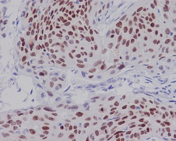 SOX2 Rabbit Monoclonal Antibody