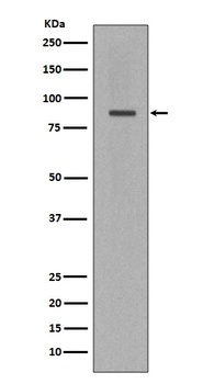 Cleaved PARP PARP1 Rabbit Monoclonal Antibody
