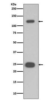 PARP PARP1 Rabbit Monoclonal Antibody