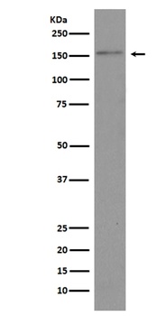 Brd4 Rabbit Monoclonal Antibody
