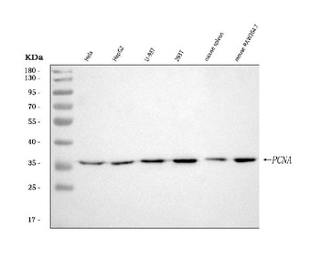 PCNA Rabbit Monoclonal Antibody