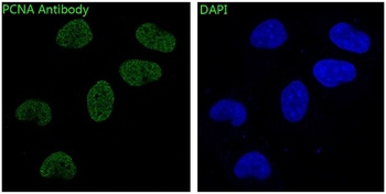 PCNA Rabbit Monoclonal Antibody