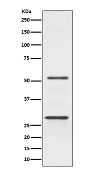 Parkin PARK2 Rabbit Monoclonal Antibody