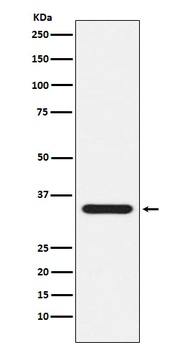 Presenilin 1 Rabbit Monoclonal Antibody