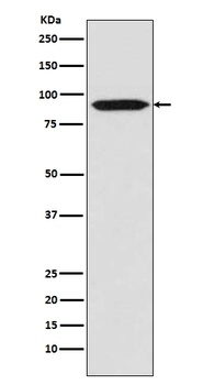 Bcl-6 Rabbit Monoclonal Antibody
