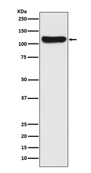 FAK PTK2 Rabbit Monoclonal Antibody