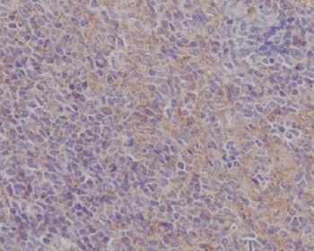 FAK PTK2 Rabbit Monoclonal Antibody
