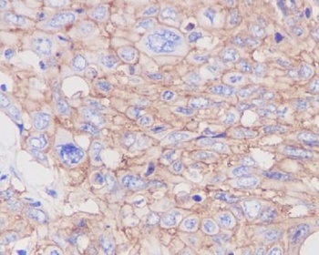 GLUT1 SLC2A1 Rabbit Monoclonal Antibody