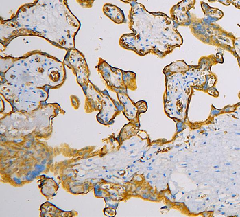 SLC2A1 Mouse Monoclonal Antibody