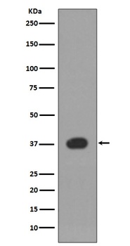 p38 MAPK14 Rabbit Monoclonal Antibody