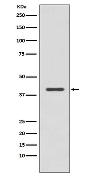 p38 MAPK MAPK14 Rabbit Monoclonal Antibody