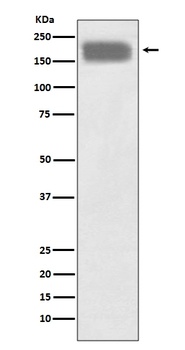NCAM NCAM1 Rabbit Monoclonal Antibody