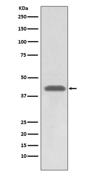 MHC class 1 HLA-A/HLA Rabbit Monoclonal Antibody