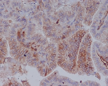 MHC class 1 HLA-A/HLA Rabbit Monoclonal Antibody
