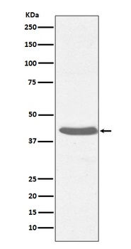 MHC class I HLA-A/HLA Rabbit Monoclonal Antibody