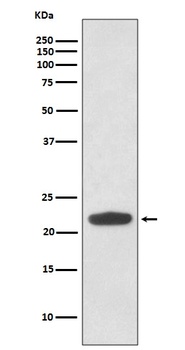 Rho RHOA Rabbit Monoclonal Antibody