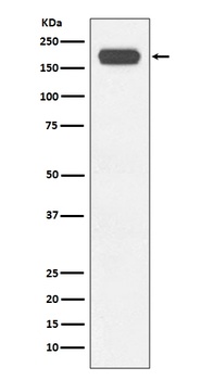 BRG1 Rabbit Monoclonal Antibody