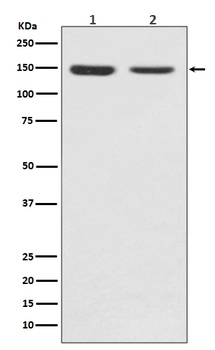 FGFR2 Rabbit Monoclonal Antibody