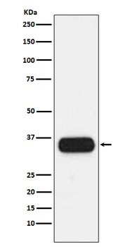 HLA-DQA1/HLA Rabbit Monoclonal Antibody