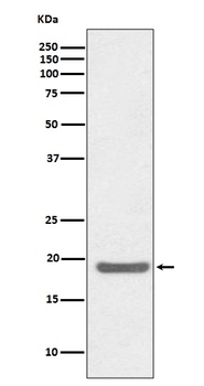 SOD1/Cu Zn Sod Rabbit Monoclonal Antibody