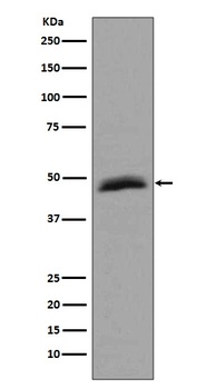 Aurora A AURKA Rabbit Monoclonal Antibody