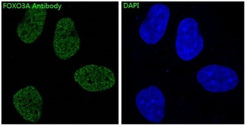 FoxO3a Rabbit Monoclonal Antibody