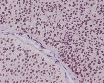 FoxO3a Rabbit Monoclonal Antibody