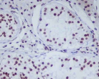 HDAC1 Rabbit Monoclonal Antibody