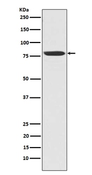 NAK/TBK1 Rabbit Monoclonal Antibody