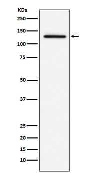 MDA5 Rabbit Monoclonal Antibody