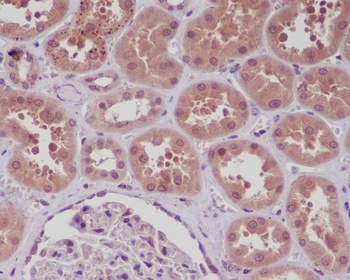 NF-Kappa B NFKB1/NF Rabbit Monoclonal Antibody