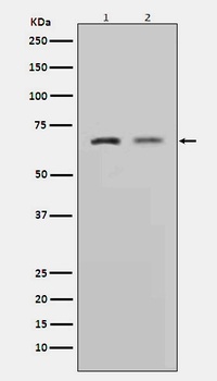 MMP2 Rabbit Monoclonal Antibody