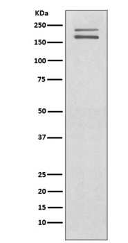 Ret Rabbit Monoclonal Antibody
