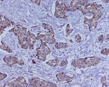 BMP4 Rabbit Monoclonal Antibody