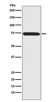 Menin MEN1 Rabbit Monoclonal Antibody