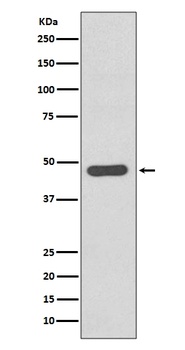 Tissue Factor Rabbit Monoclonal Antibody