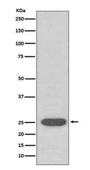 SOD2/Mnsod Rabbit Monoclonal Antibody
