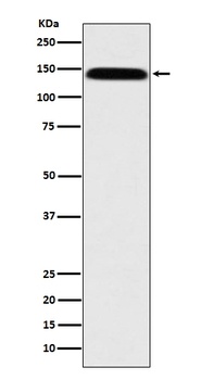 Leptin Receptor LEPR Rabbit Monoclonal Antibody