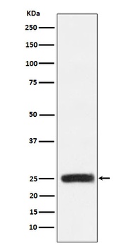GRB2 Rabbit Monoclonal Antibody