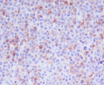 Granzyme B GZMB Rabbit Monoclonal Antibody