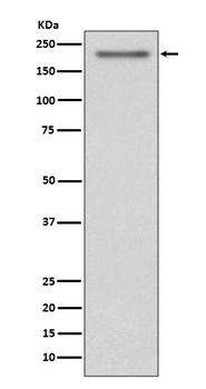 PDGFR alpha Rabbit Monoclonal Antibody
