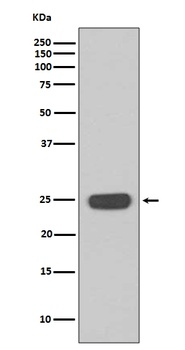 Interferon gamma IFNG Rabbit Monoclonal Antibody