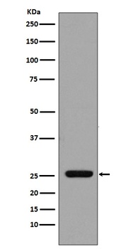 GST GSTP1 Rabbit Monoclonal Antibody