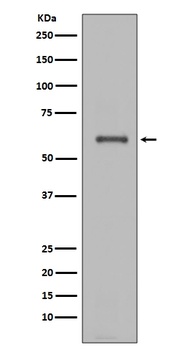 NOX4 Rabbit Monoclonal Antibody