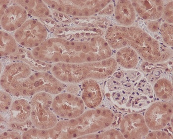 NOX4 Rabbit Monoclonal Antibody