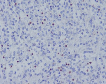 TBX21 Rabbit Monoclonal Antibody